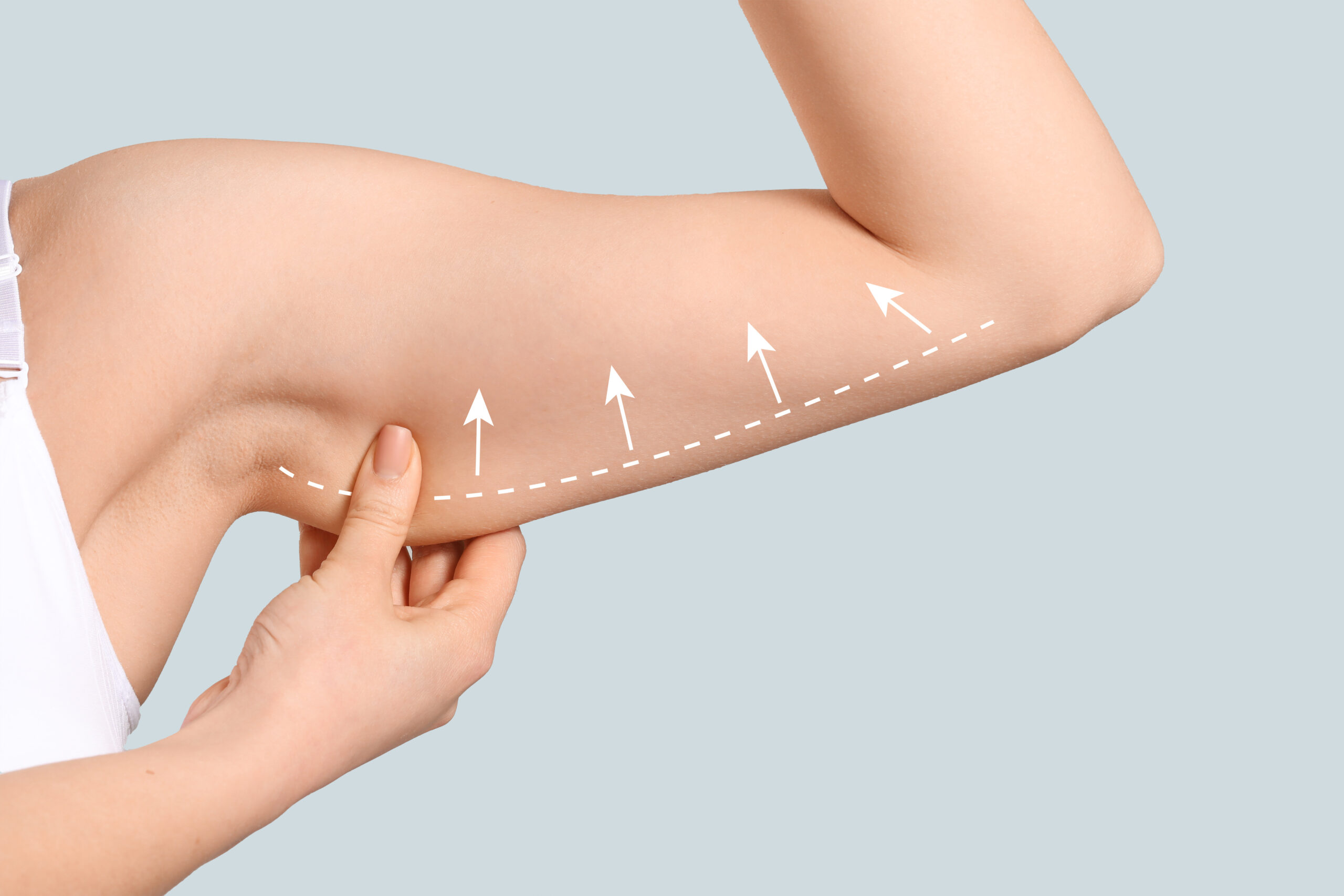 Arm of young woman after slimming on light background