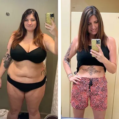 Michelle-B-Before-and-After