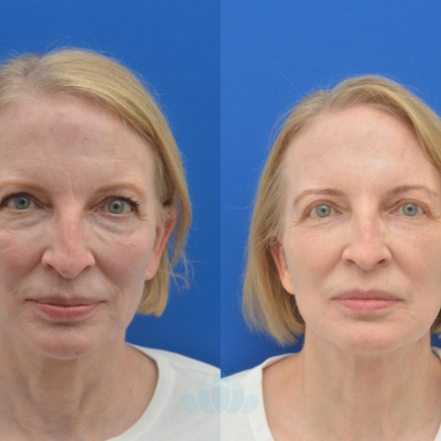 Untitled design - 2026-02-03T154755.772