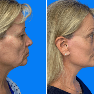 Untitled design - 2026-02-03T155336.812