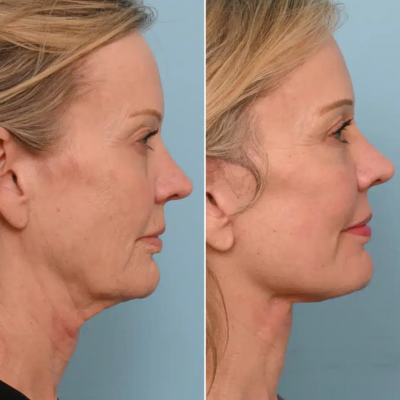 Untitled design - 2026-02-03T155420.520