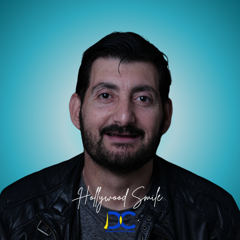 Hollywood Smile (11)