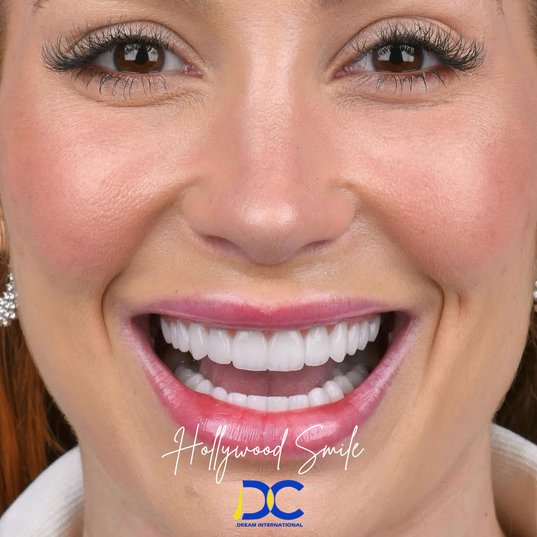 Hollywood Smile (55)