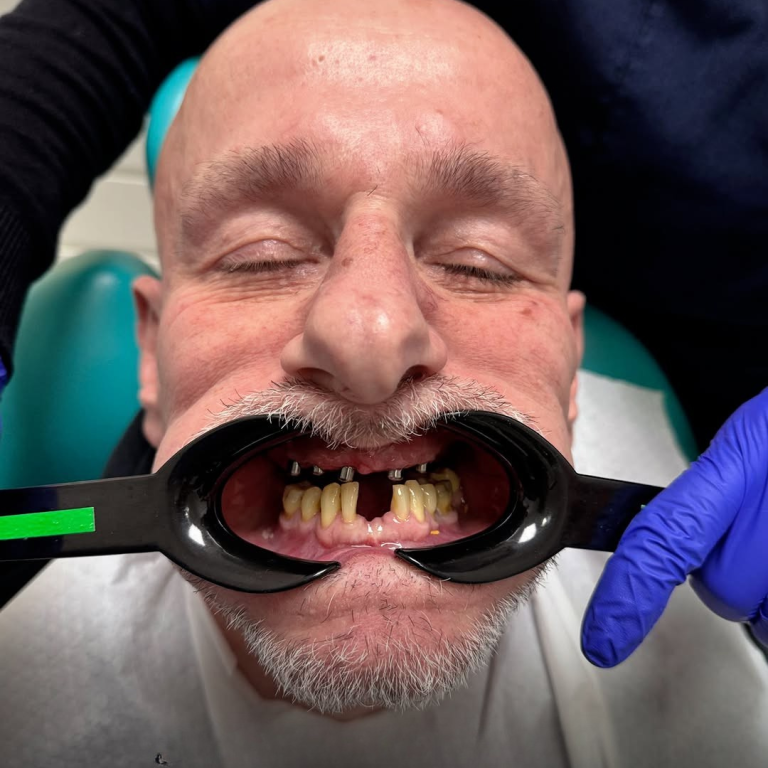 hollywood smile (31)