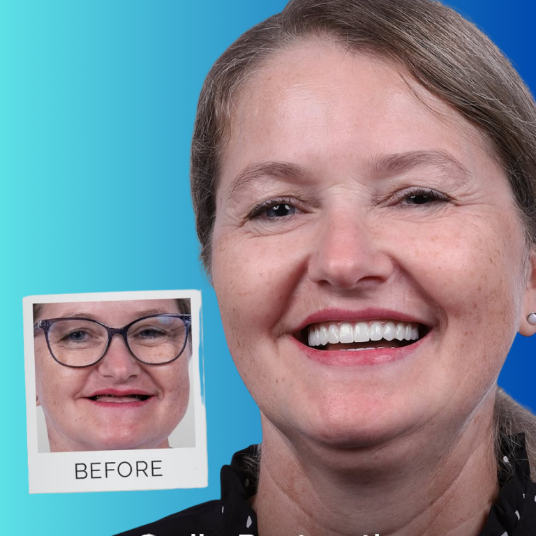 hollywood smile (39)