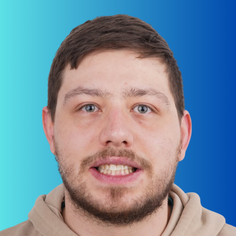 hollywood smile (8) (1)